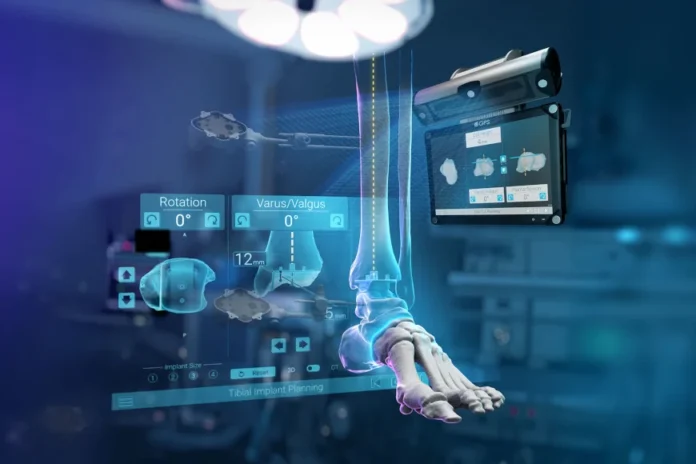 Exactech GPS Ankle – rewolucja w chirurgii stawu skokowego wchodzi na światowe rynki