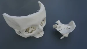 Druk 3D w laryngologii: Bielsko-Biała wdraża nową jakość symulacji