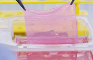 Przełom w leczeniu oparzeń: ofiary pożaru w Crans-Montana otrzymują skórę z własnych komórek