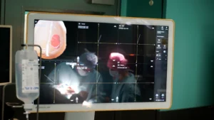 Pionierska operacja glejaka z użyciem PET 18F-FET. Nowa metoda w Łodzi