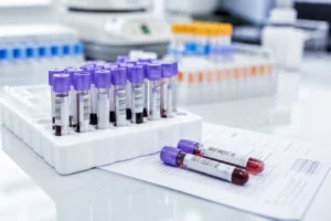Pojedyncza próbka krwi może przewidzieć nawrót raka jelita grubego. Szansa na dokładniejsze rokowanie