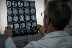 Pierwsza taka immunoterapia u ludzi wydłużyła przeżycie bez progresji glejaka ponad dwukrotnie